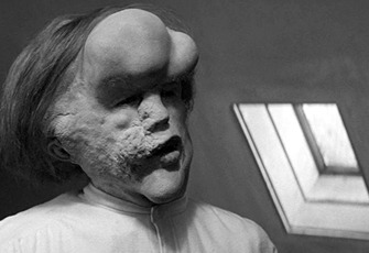 The Elephant Man