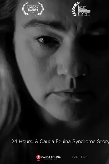 24 Hours: A Cauda Equina Syndrome Story