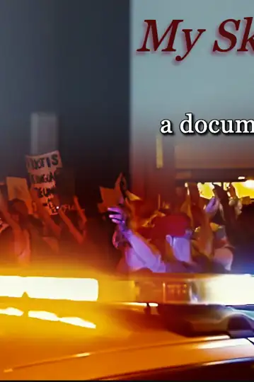 My Skin Is Not A Sin [docushort]