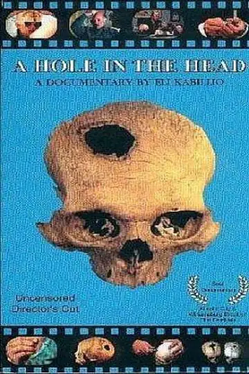 A Hole in the Head