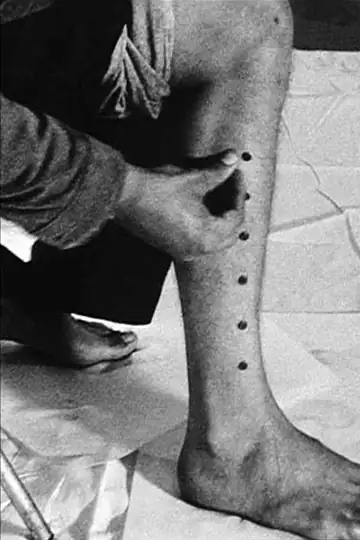 Tack Line/Push Tacks Into Your Leg Until a Line of Tacks Has Been Made Up Your Leg